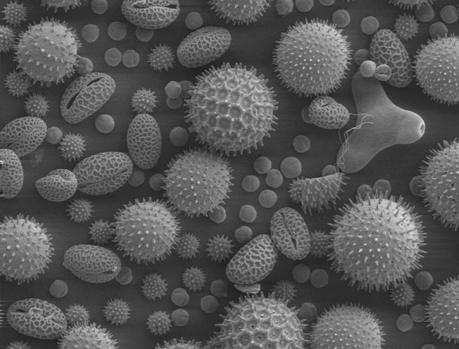 Electron microscope image of pollen